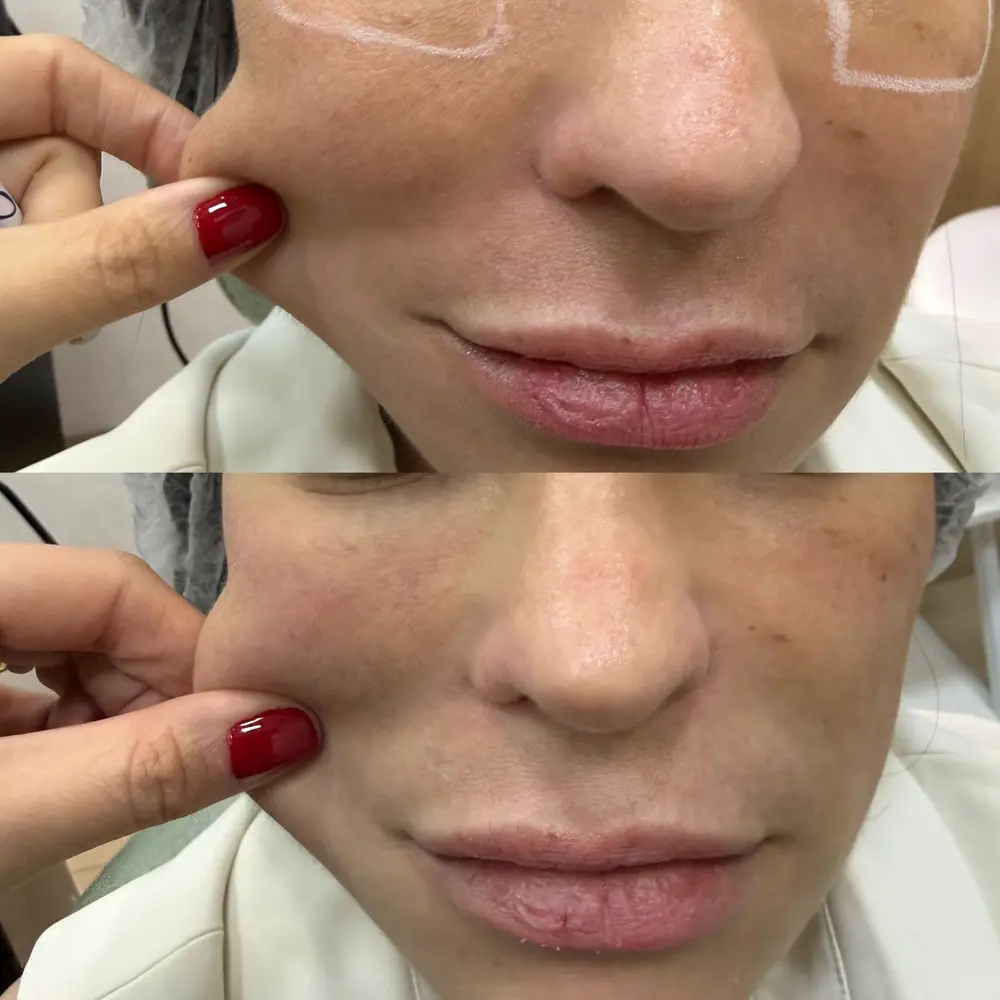 Comparativo da qualidade da pele facial
