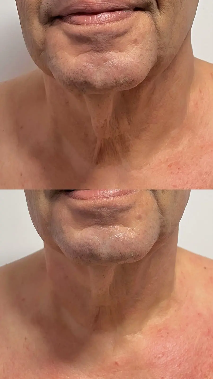 Comparativo da qualidade da pele do rosto e pescoço