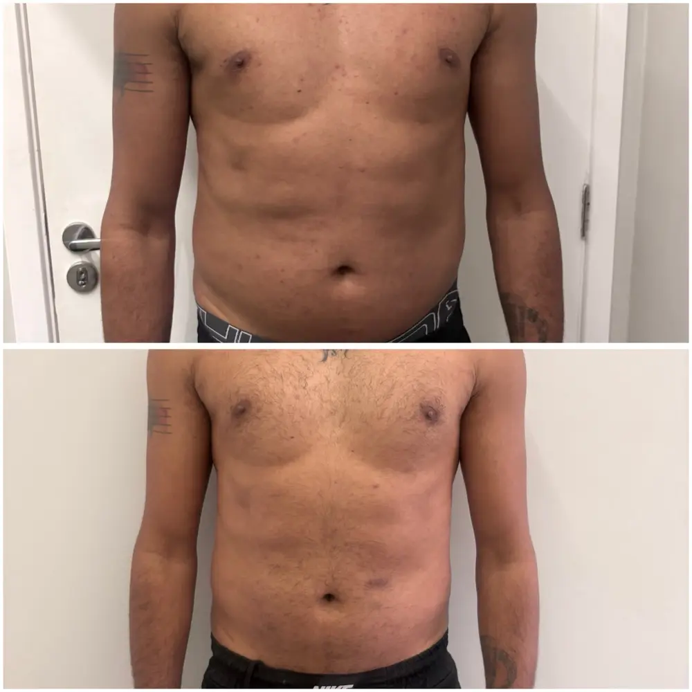 Comparativo de resultado corporal masculino